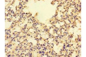 Immunohistochemistry of paraffin-embedded human lung tissue using ABIN7142435 at dilution of 1:100 (MRPL39 anticorps  (AA 1-158))