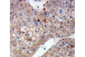 Used in DAB staining on fromalin fixed paraffin-embedded Liver tissue