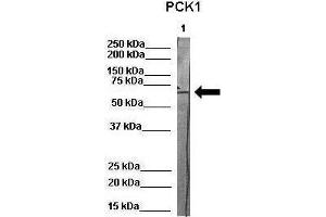 WB Suggested Anti-PCK1 Antibody    Positive Control:  Lane 1: 80ug pig serum protein   Primary Antibody Dilution :   1:1000  Secondary Antibody :  Anti-rabbit-HRP   Secondry Antibody Dilution :   1:500  Submitted by:  Martina Ondrovics, University of Veterinary Medicine Vienna (PCK1 anticorps  (Middle Region))