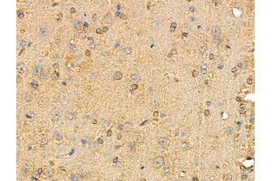 ABIN6258206 and ABIN6274351 at 1/100 staining Rat brain tissue by IHC-P. (GIT2 anticorps  (Internal Region))