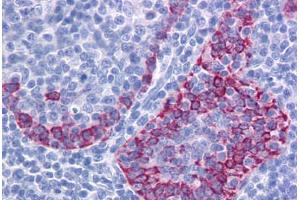 Human Tonsil: Formalin-Fixed, Paraffin-Embedded (FFPE)
