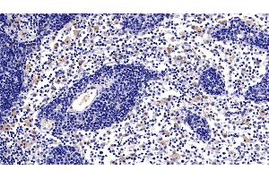 Detection of CD40L in Rat Lymph node Tissue using Polyclonal Antibody to Cluster Of Differentiation 40 Ligand (CD40L)