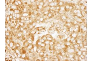 Immunohistochemistry (IHC) image for anti-Ribosomal Protein L7 (RPL7) (C-Term) antibody (ABIN7449014) (RPL7 anticorps  (C-Term))