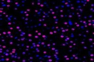 Immunofluorescent analysis of paraformaldehyde-fixed rat adrenal gland using TPRKB (ABIN7075943) at dilution of 1: 1000