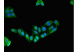 Immunofluorescent analysis of HepG2 cells using ABIN7151428 at dilution of 1:100 and Alexa Fluor 488-congugated AffiniPure Goat Anti-Rabbit IgG(H+L)