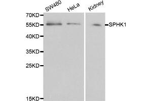 Western blot analysis of extracts of various cell lines, using SPHK1 antibody. (SPHK1 anticorps)