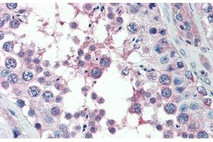 Immunohistochemistry with Human Testis lysate tissue at an antibody concentration of 5.