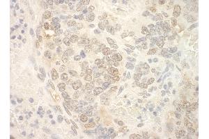 Immunohistochemistry (IHC) image for anti-Nuclear Cap Binding Protein Subunit 2 (NCBP2) (AA 106-156) antibody (ABIN7448682)