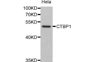 Western blot analysis of extracts of HeLa cells, using CTBP1 antibody (ABIN1872058). (CTBP1 anticorps)