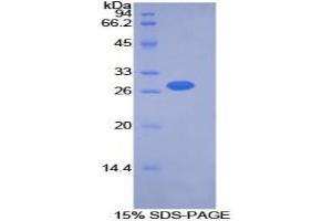 SDS-PAGE analysis of Mouse PDK2 Protein.