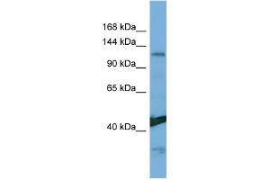 Host:  Rabbit  Target Name:  NINL  Sample Type:  Hela Whole Cell lysates  Antibody Dilution:  1. (NINL anticorps  (Middle Region))