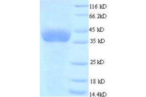 Glyceraldehyde-3-Phosphate Dehydrogenase (GAPDH) (AA 2-333) protein (His tag) expressed in E.
