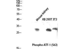 Western Blot (WB) analysis of Mouse Kidney KB 293T 3T3 lysis using Phospho-ATF-1 (S63) antibody. (AFT1 anticorps  (pSer63))