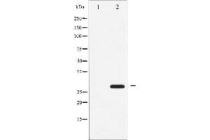 Western blot analysis of ATF1 expression in COLO205 whole cell lysates,The lane on the left is treated with the antigen-specific peptide. (AFT1 anticorps  (Internal Region))