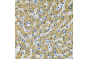 Immunohistochemistry of paraffin-embedded human liver injury using SDC4 Antibody (ABIN5970935) at dilution of 1/100 (40x lens). (SDC4 anticorps)