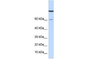 Western Blot showing ZNF251 antibody used at a concentration of 1-2 ug/ml to detect its target protein. (ZNF251 anticorps  (Middle Region))