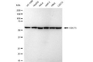Western blotting analysis using CDC73 antibody (ABIN7799734). (Recombinant HRPT2 anticorps)