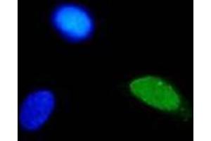 Immunofluorescence (IF) image for anti-Human Papilloma Virus Type 11 (HPV-11) (AA 83-201) antibody (ABIN781774) (Humain Papilloma Virus Type 11 (HPV-11) (AA 83-201) anticorps)