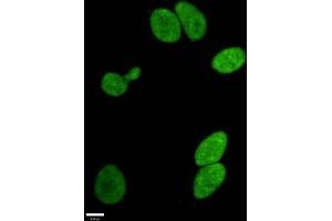 Immunofluorescence staining of Hela cells withABIN7127303 at 1:96,counter-stained with DAPI.