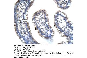 Rabbit Anti-STAU1 Antibody  Paraffin Embedded Tissue: Human Intestine Cellular Data: Epithelial cells of intestinal villas Antibody Concentration: 4.