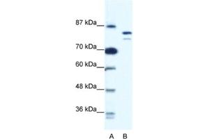 Western Blotting (WB) image for anti-Minichromosome Maintenance Deficient 8 (MCM8) antibody (ABIN2461402) (MCM8 anticorps)