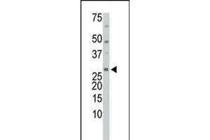 Antibody is used in Western blot to detect TrxL in HL-60 cell lysate. (TXNL1 anticorps  (C-Term, Trp32))