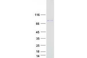 Validation with Western Blot