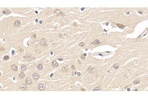 Detection of GFRa1 in Human Cerebrum Tissue using Polyclonal Antibody to Glial Cell Line Derived Neurotrophic Factor Receptor Alpha 1 (GFRa1)