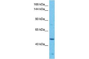 Host:  Rabbit  Target Name:  MAP3K1  Sample Tissue:  Human Jurkat Whole Cell  Antibody Dilution:  1ug/ml (MAP3K1 anticorps  (C-Term))