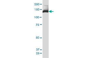 PIK3R4 monoclonal antibody (M02), clone 1B5 Western Blot analysis of PIK3R4 expression in HeLa .