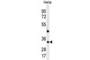 Western Blotting (WB) image for anti-Mediator Complex Subunit 7 (MED7) antibody (ABIN2996463)