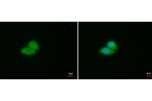 ICC/IF Image VHL antibody detects VHL protein at cytoplasm and nucleus by immunofluorescent analysis.
