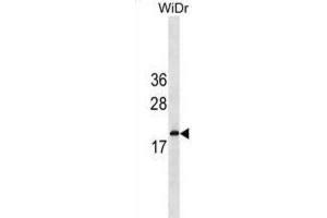 Western Blotting (WB) image for anti-Interferon, alpha 5 (IFNA5) antibody (ABIN3000243) (IFNA5 anticorps)