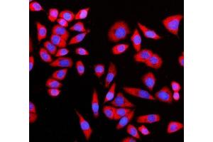 IF analysis of GIGYF2 using anti-GIGYF2 antibody (ABIN7601679). (GIGYF2 anticorps  (AA 413-1299))