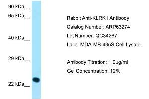 Western Blotting (WB) image for anti-Killer Cell Lectin-Like Receptor Subfamily K, Member 1 (KLRK1) (C-Term) antibody (ABIN2789432) (KLRK1 anticorps  (C-Term))