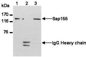 Western Blotting (WB) image for anti-Splicing Factor 3b, Subunit 1, 155kDa (SF3B1) (AA 98-198) antibody (ABIN1449241)