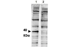 Western blot using PACRG polyclonal antibody  shows detection of aband ~ 40 KDa corresponding to human PACRG (arrowhead lane 1).