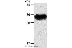 Western blot analysis of Mouse brain tissue, using STX1A Polyclonal Antibody at dilution of 1:600 (STX1A anticorps)