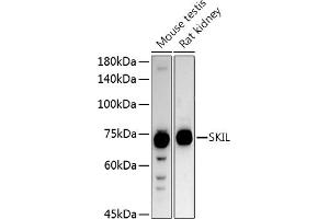 Western blot analysis of extracts of various cell lines, using SKIL antibody (ABIN6130691, ABIN6147811, ABIN6147812 and ABIN6221543) at 1:1000 dilution. (SKIL anticorps  (AA 420-684))