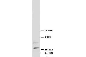 Anti-NGF antibody, Western blotting WB: Rat Brain Tissue Lysate (Nerve Growth Factor anticorps  (N-Term))
