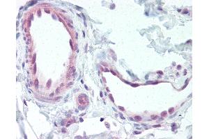 Anti-EDNRB antibody IHC of human vessels.