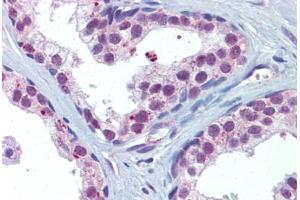 anti-V-Akt Murine Thymoma Viral Oncogene Homolog 1/2 (AKT1/2) antibody