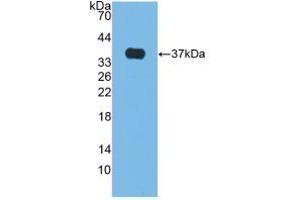 Figure. (Alkaline Phosphatase anticorps  (AA 18-335))