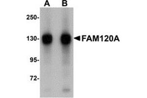 Western Blotting (WB) image for anti-Family with Sequence Similarity 120A (FAM120A) (Middle Region) antibody (ABIN1030930) (FAM120A anticorps  (Middle Region))
