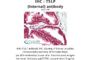 Image no. 3 for anti-Thymic Stromal Lymphopoietin (TSLP) (Internal Region) antibody (ABIN1740422) (Thymic Stromal Lymphopoietin anticorps  (Internal Region))