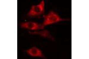 ABIN6274775 staining COLO205 cells by IF/ICC. (RPL27A anticorps  (C-Term))