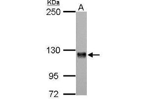 WB Image Amphiphysin antibody [N1N2], N-term detects AMPH protein by Western blot analysis. (Amphiphysin anticorps  (N-Term))