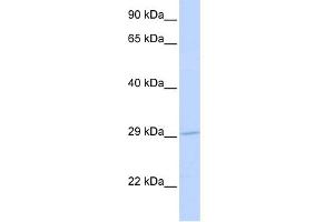 WB Suggested Anti-SLC25A6 Antibody Titration: 0. (SLC25A6 anticorps  (N-Term))