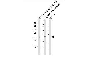 All lanes : Anti-S1 tag Antibody Antibody at 1:2000 dilution Lane 1: 293T/17 transfected with 6 tag lysate Lane 2: 6 tag recombinant protein lysate Lane 3: 293T/17 whole cell lysate Lysates/proteins at 20 μg per lane. (S1-Tag anticorps)