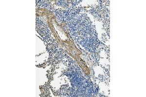 IHC analysis of VCL using anti-VCL antibody (ABIN7599003). (Vinculin anticorps  (AA 1-149))